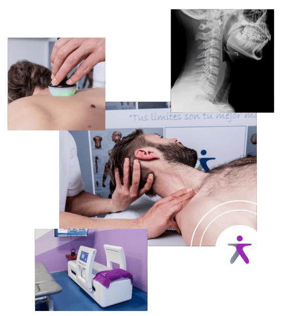 collage de técnicas de fisioterapia para la artrosis lumbar y cervical