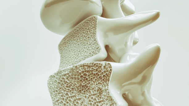 osteoporosis en la columna