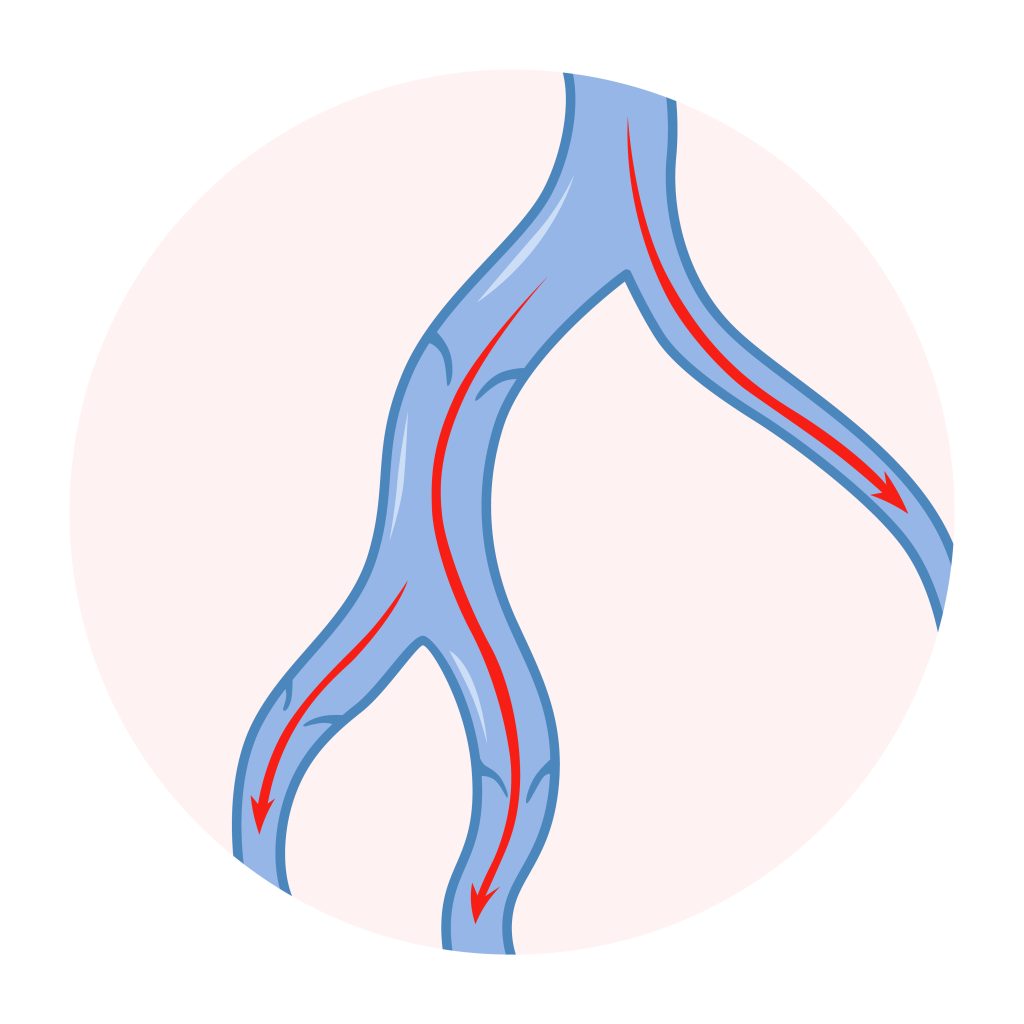 ¿Qué es la oclusión vascular? | Vitalys Center