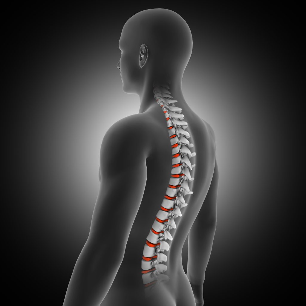 Todo lo que debes saber sobre la escoliosis | Vitalys Center
